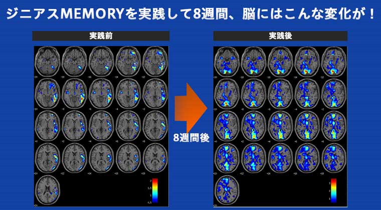 ジニアスMEMORYの脳の変化